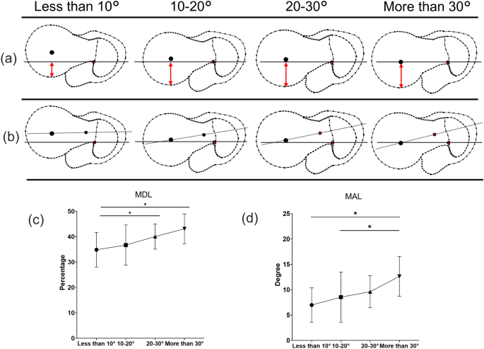 Correlation between lag screw route and the ideal insertion point of the intramedullary nail | Scientific Reports Correlation between lag screw route and the ideal insertion point of the intramedullary nail | Scientific Reports
