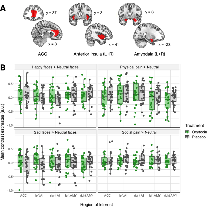 Randomized clinical trial shows no substantial modulation of  empathy-related neural activation by intranasal oxytocin in autism |  Scientific Reports