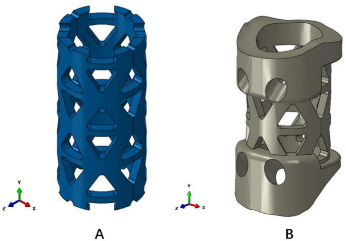 A novel anatomic titanium mesh cage for reducing the subsidence rate after  anterior cervical corpectomy: a finite element study | Scientific Reports