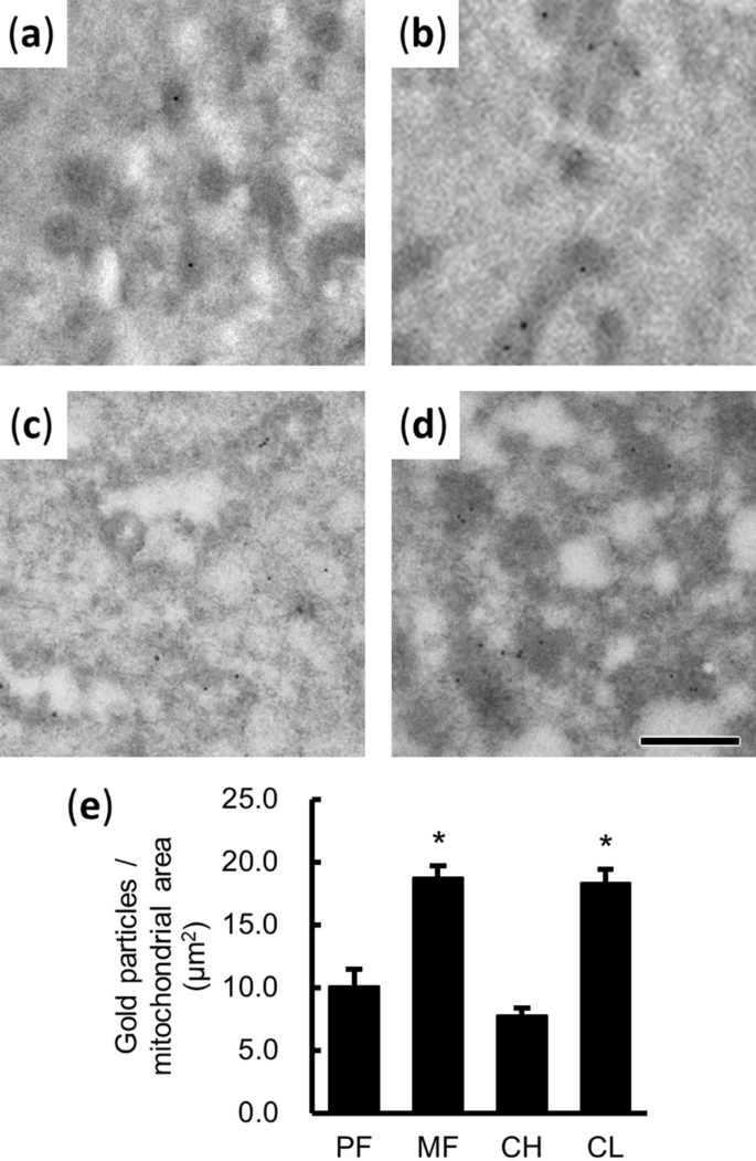 Dynamic Changes In Mitochondrial 3d Structure During Folliculogenesis And Luteal Formation In The Goat Large Luteal Cell Lineage Scientific Reports