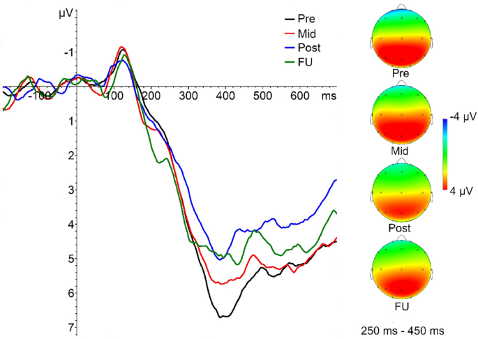 A randomized-controlled neurofeedback trial in adult attention-deficit ...