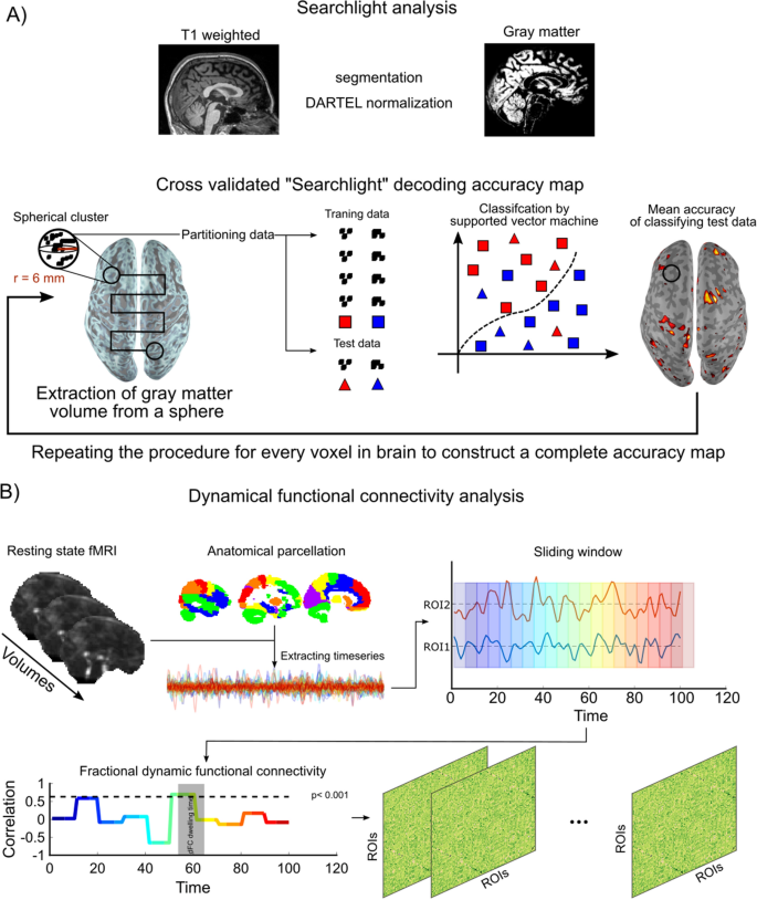 Acquired Olfactory Loss Alters Functional Connectivity And Morphology Scientific Reports