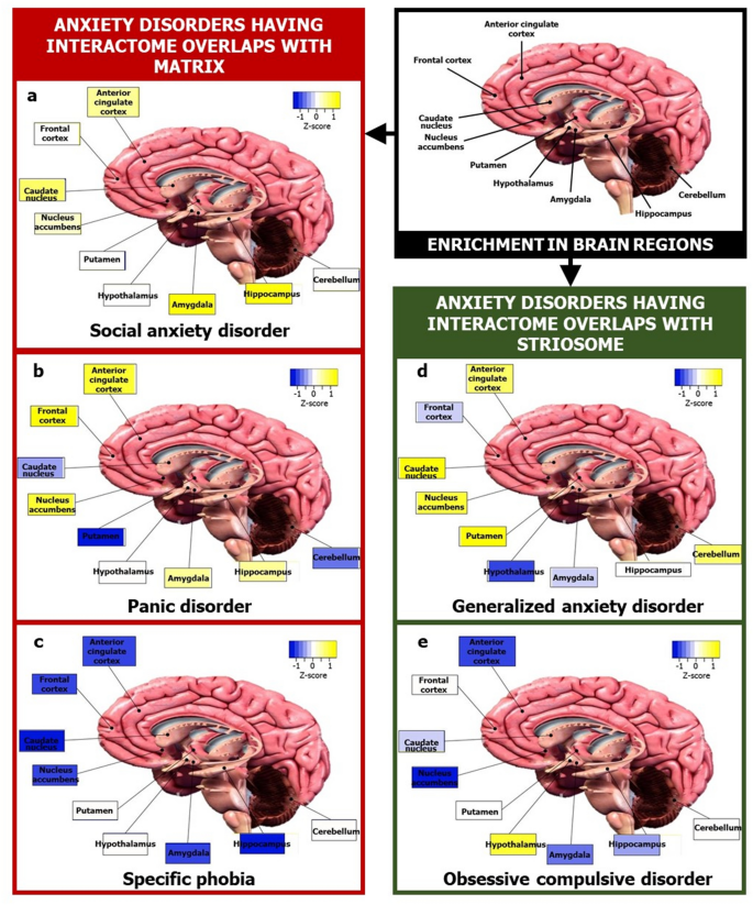 anxiety disorder brain