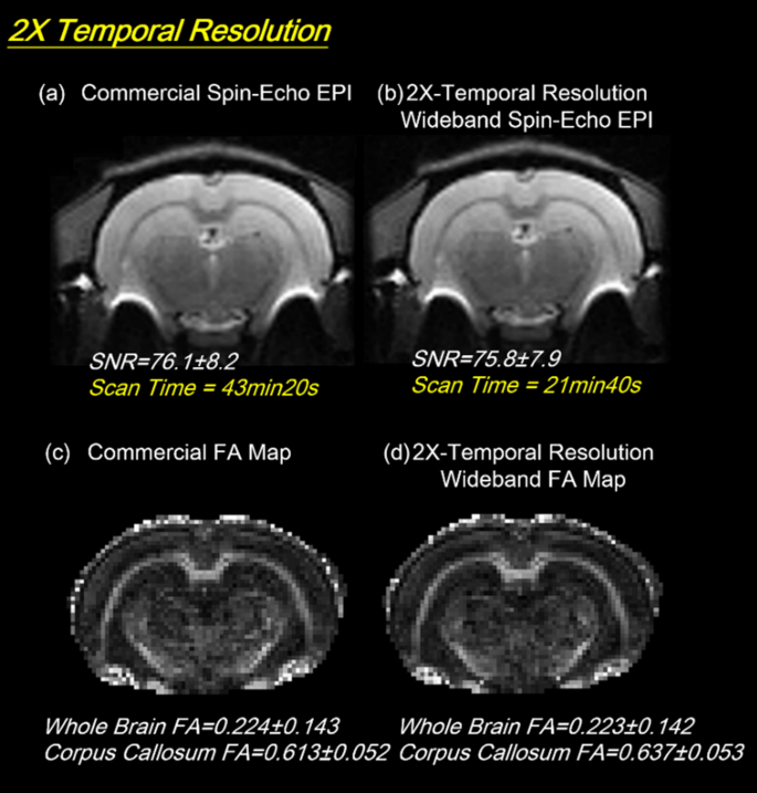Spatial resolution meets temporal resolution – Tescan UniTOM HR - 2021 -  Wiley Analytical Science