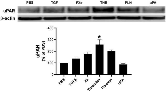TGF-β regulation of the uPA/uPAR axis modulates mesothelial-mesenchymal  transition (MesoMT) | Scientific Reports