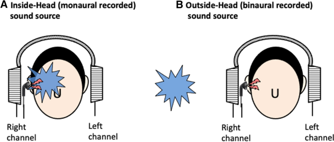 Effects of sound source localization of masking sound on perception level  of simulated tinnitus | Scientific Reports