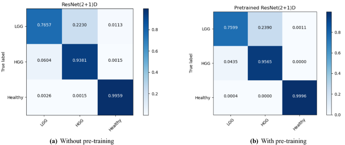 brain tumor research paper figure 4