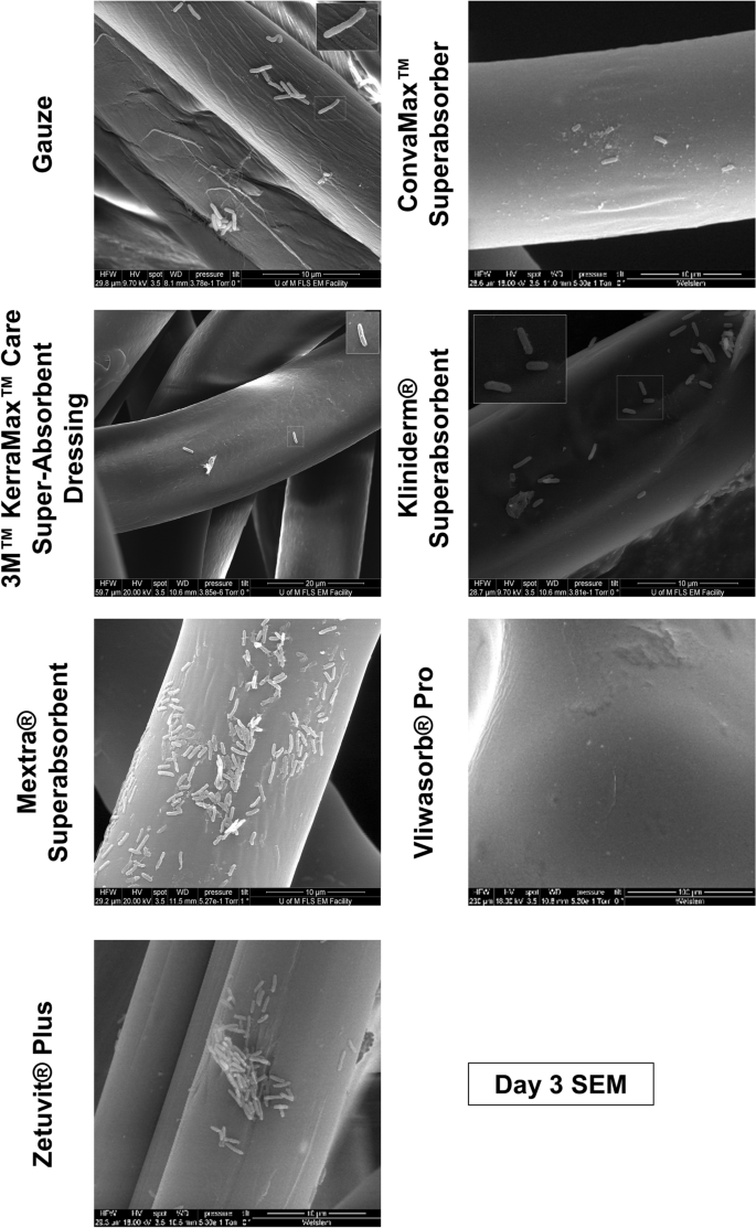 Investigating the microbial and metalloprotease sequestration properties of  superabsorbent wound dressings | Scientific Reports