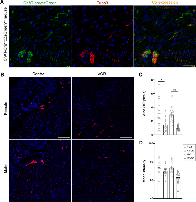 Sexual Dimorphic Impacts Of Systemic Vincristine On Lower Urinary Tract Function Scientific Reports