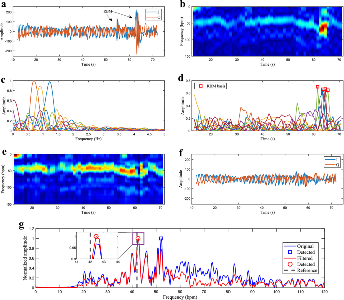 Simultaneous Touchless Monitoring of Several Patients' Vital Signs - IEEE  Spectrum