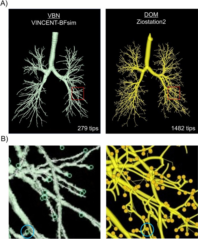 The superiority of manual over automated methods in identifying bronchial  trees on identical CT images | Scientific Reports