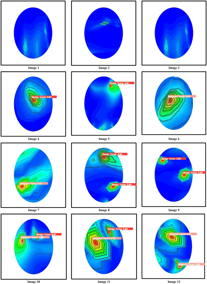 figure 22