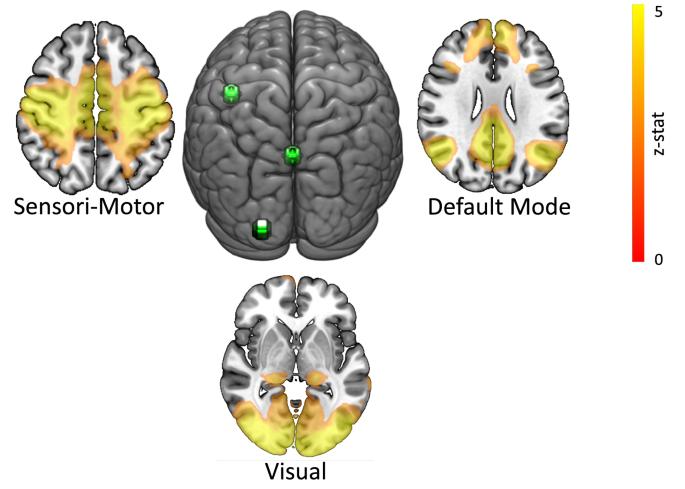 Static magnetic field stimulation over motor cortex modulates resting  functional connectivity in humans | Scientific Reports