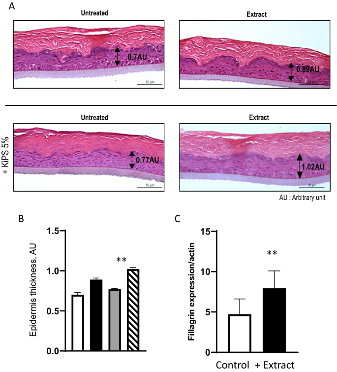 Human skin reconstitution in the cell-sorted skin equivalent (CeSSE)