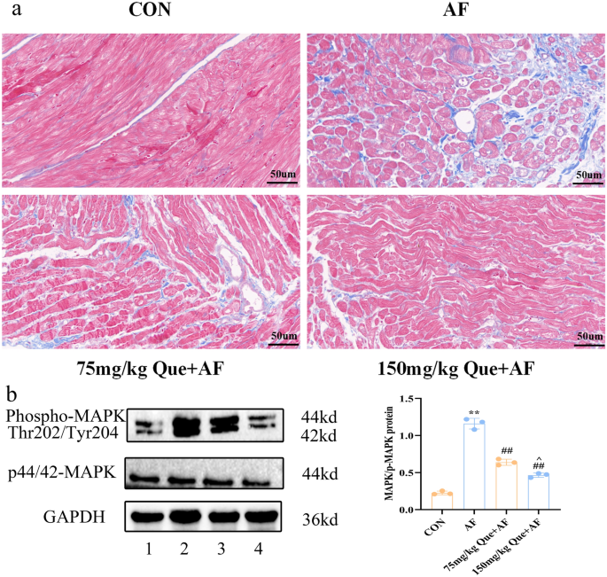 Mechanisms Of Quercetin Against Atrial Fibrillation Explored By Network Pharmacology Combined With Molecular Docking And Experimental Validation Scientific Reports