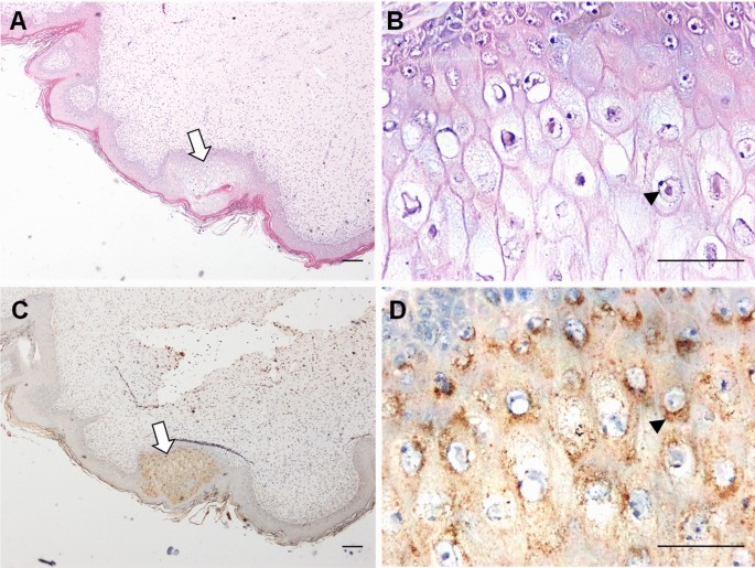 Frontiers  Evidence of chelonid herpesvirus 5 infection in green