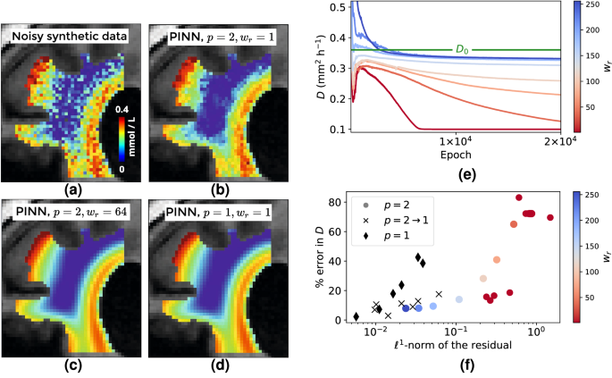 Investigating molecular transport in the human brain from MRI with physics-informed neural networks | Scientific Reports