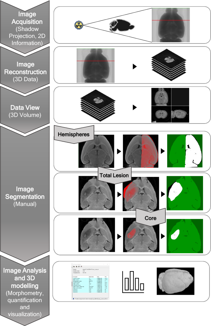 High-resolution micro-CT for 3D infarct characterization and segmentation  in mice stroke models