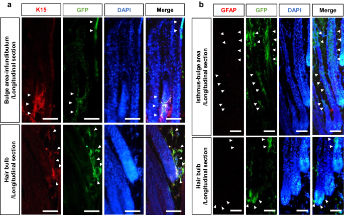 Hair follicle associated pluripotent (HAP) stem cells jump from  transplanted whiskers to pelage follicles and stimulate hair growth |  Scientific Reports