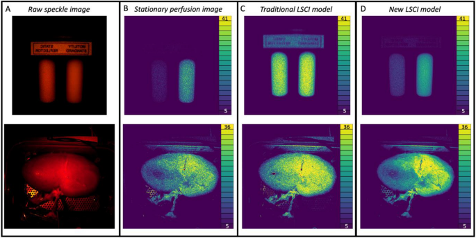 Real-time, multi-spectral motion artefact correction and compensation for laser  speckle contrast imaging | Scientific Reports