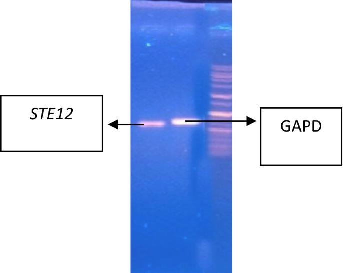 figure 16