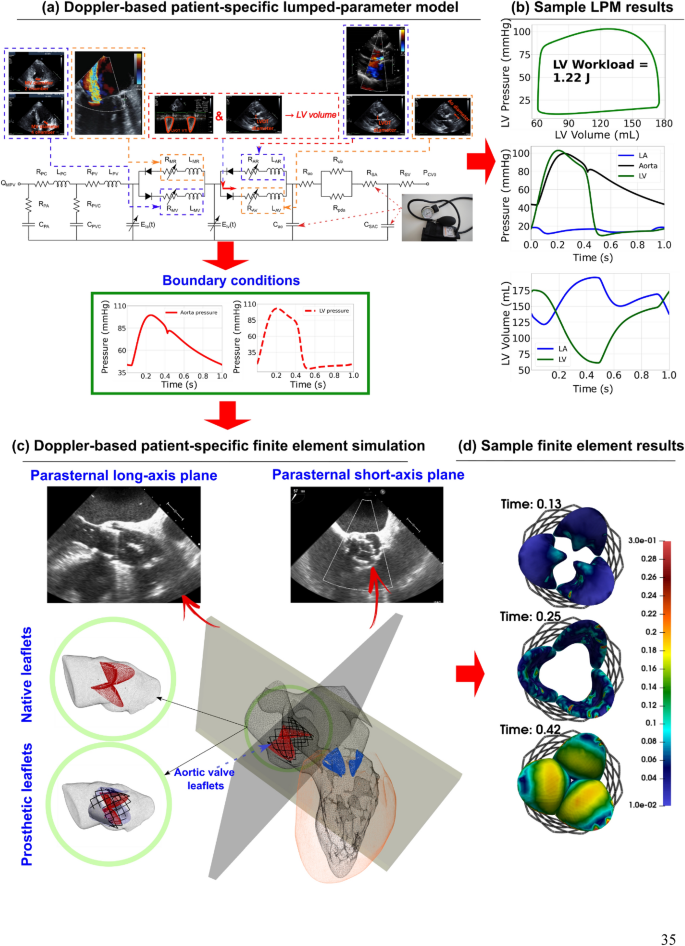 A Doppler-exclusive non-invasive computational diagnostic 
