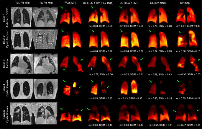 PhysVENeT: a physiologically-informed deep learning-based 