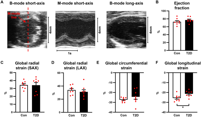 Echocardiographic Speckle-Tracking Based Strain Imaging for Rapid  Cardiovascular Phenotyping in Mice