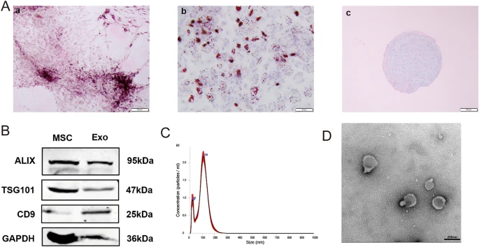 Exosomes secreted by mesenchymal stem cells delay brain aging by upregulating SIRT1 expression