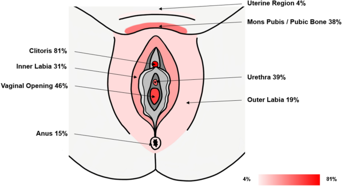 Clinical characterisation of women with persistent genital arousal 