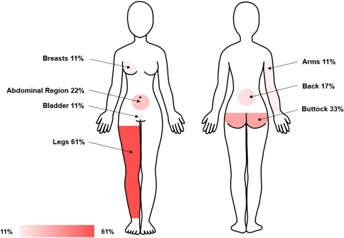 Picture of Persistent genital arousal disorder