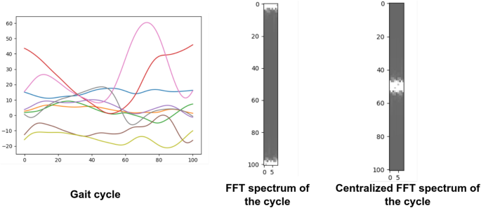 gait analysis case study figure 9