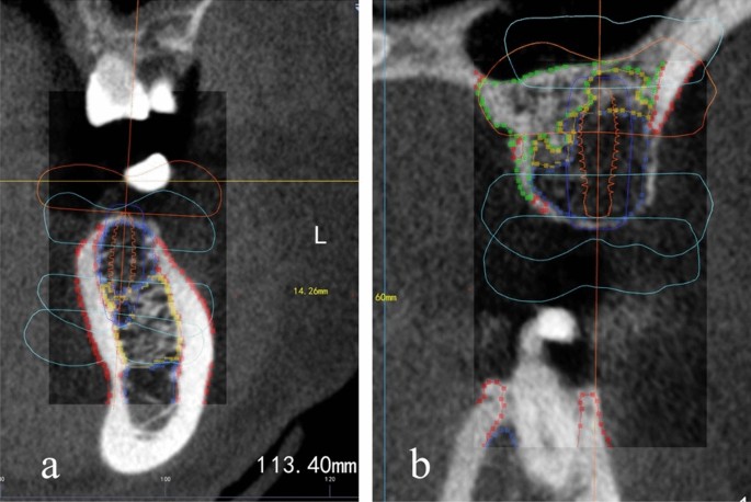figure 9