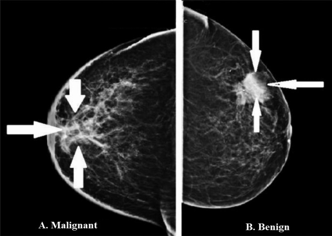machine learning case study binary classification figure 1