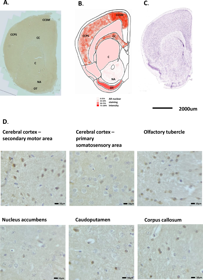 propionyl-l-carnitine with cialis Acetyl-l-carnitine plus propionyl-l-carnitine improve efficacy of  sildenafil in treatment of erectile dysfunction after bilateral  nerve-sparing radical retropubic prostatectomy