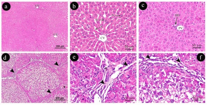 Aging promotes metabolic dysfunction-associated steatotic liver disease by inducing ferroptotic stress