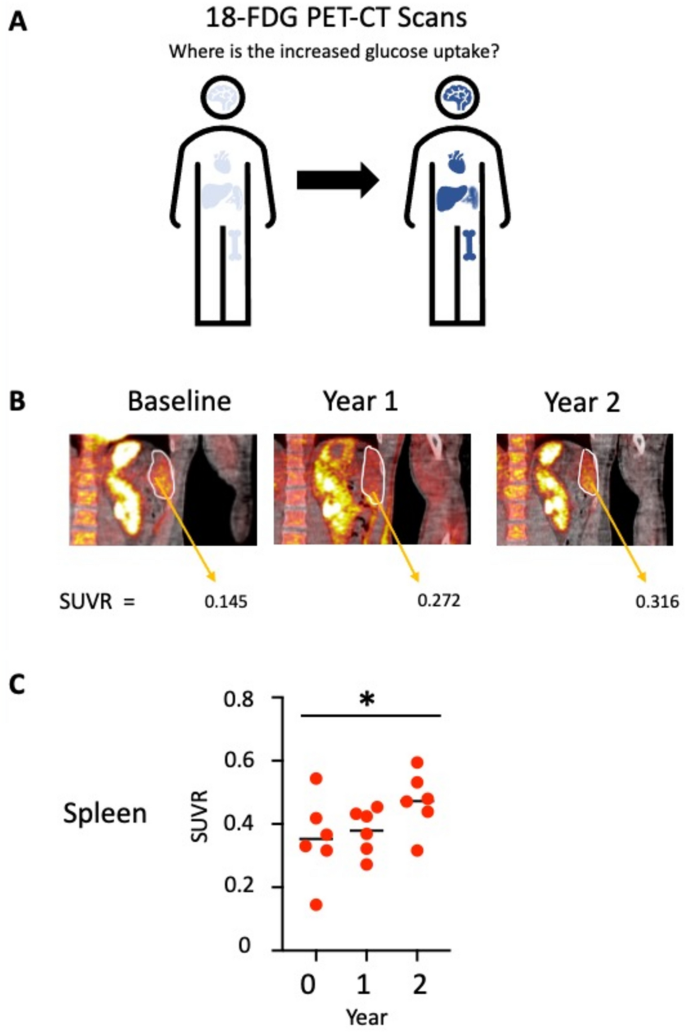 semaglutide spleen The spleen assumes a major role in blood glucose regulation in type 1  diabetes patients treated with BCG