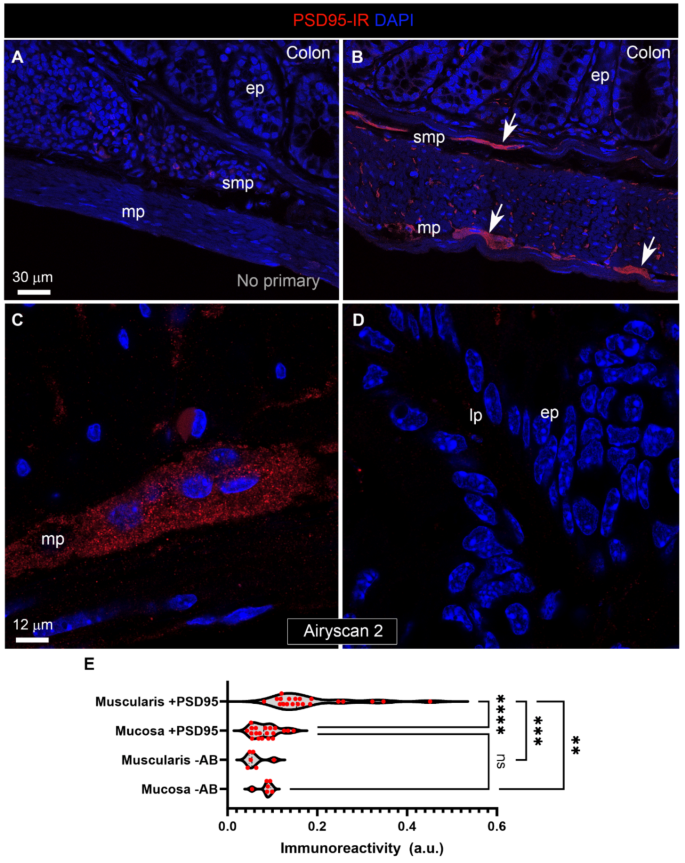 Limited evidence for anatomical contacts between intestinal GLP-1 cells and vagal neurons in male mice