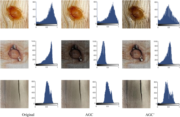figure 11