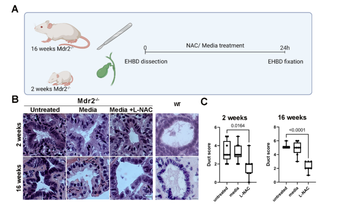 Oral N-acetylcysteine ameliorates liver fibrosis and enhances regenerative responses in Mdr2 knockout mice | Scientific Reports Oral N-acetylcysteine ameliorates liver fibrosis and enhances regenerative responses in Mdr2 knockout mice | Scientific Reports