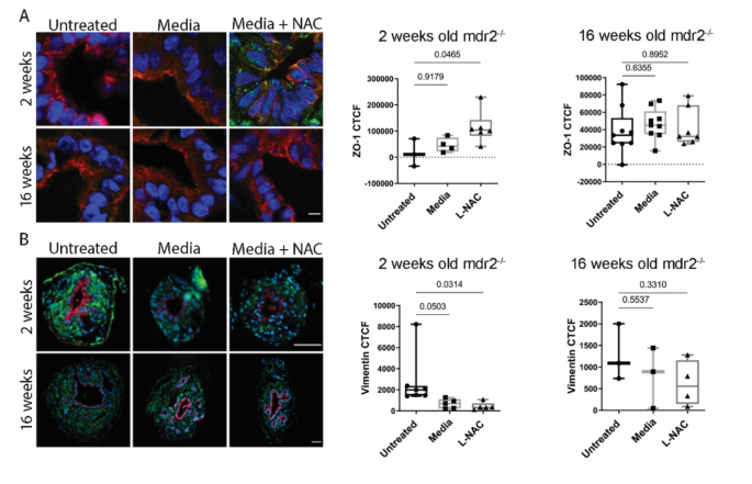 nac glutathione liver protection aas The efficacy of N-acetylcysteine in improving liver function: A systematic  review and meta-analysis of controlled clinical trials