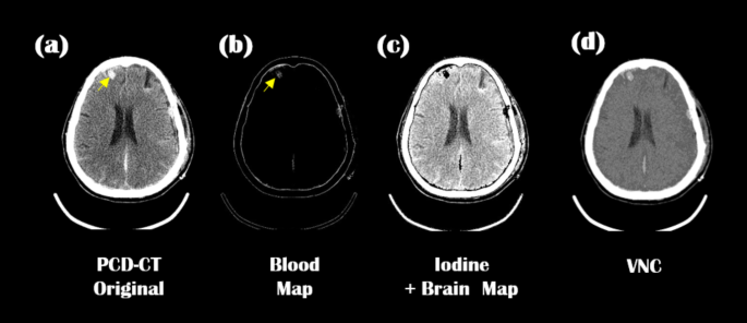 figure 14