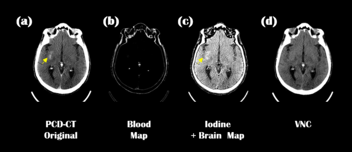 figure 15