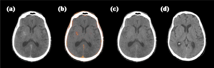 figure 17