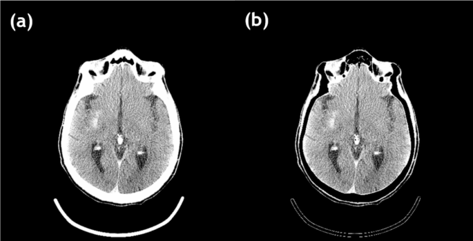 figure 19