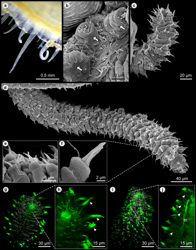 Anatomy and transcriptomics of the common jingle shell (Bivalvia 
