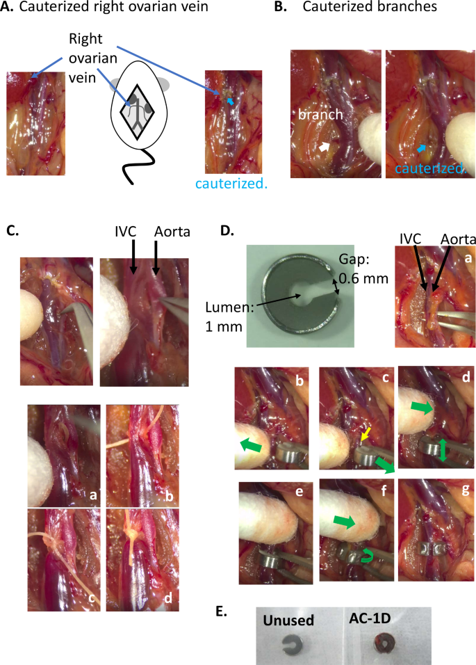 A mouse model of deep vein thrombosis by inferior vena cava 