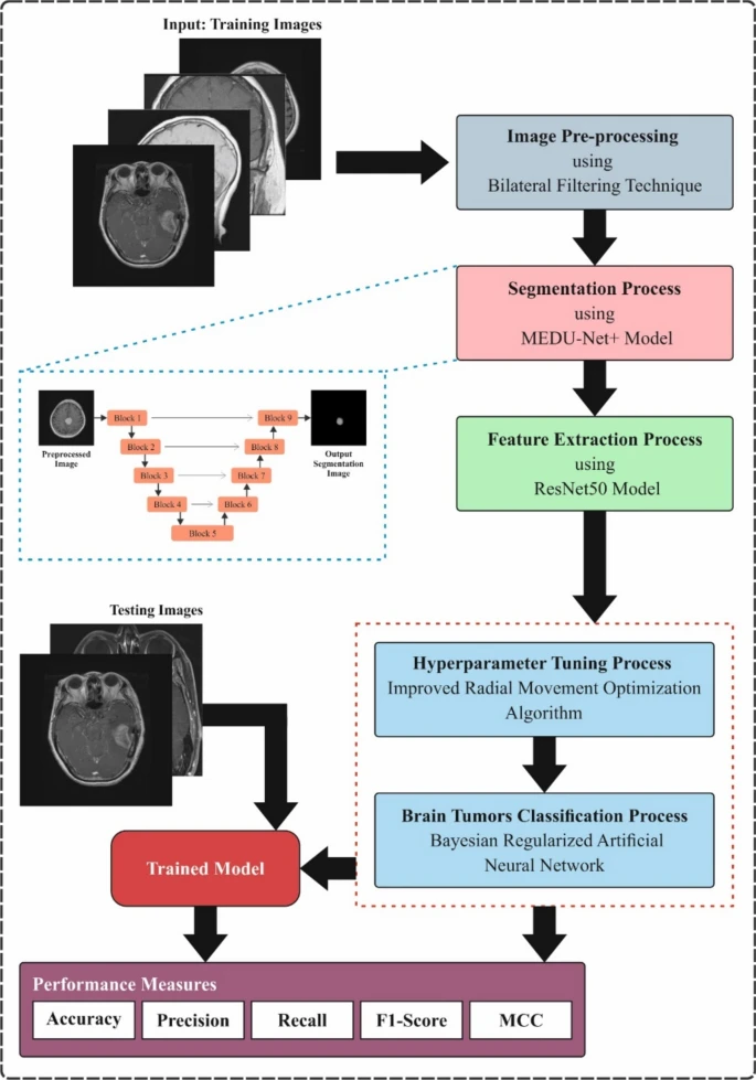 Explainable artificial intelligence with UNet based segmentation and Bayesian machine learning for classification of brain tumors using MRI images