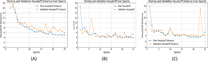 Training and validation hausdorff distance graphs of a SegNet, b UNet with ResNet-34 and c proposed ResAttentionUNet++.