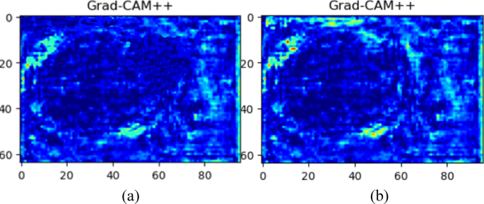 Explainable AI Grad-cam++ heatmap of a UNet with ResNet-34, and b Proposed ResAttentionUNet++.